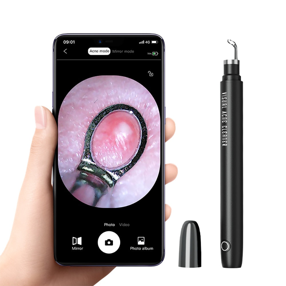 Smart Visual Blackhead Remover